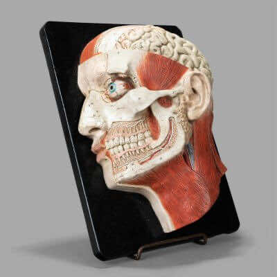 Plaster Didactic Skin Model by Bock-Steger, End of XIXth c.