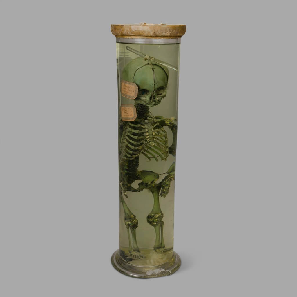 Fetal Skeleton Preserved in Jar , Early XXth