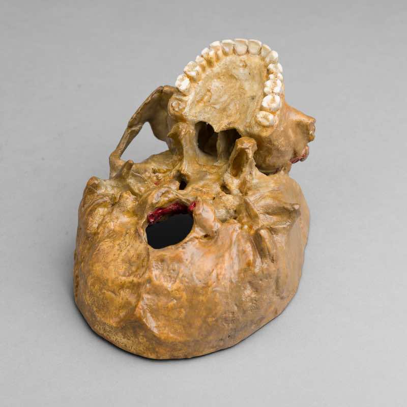 Anatomical Wax Model of Skull and Eye, between 1880 and 1900 - Image 6