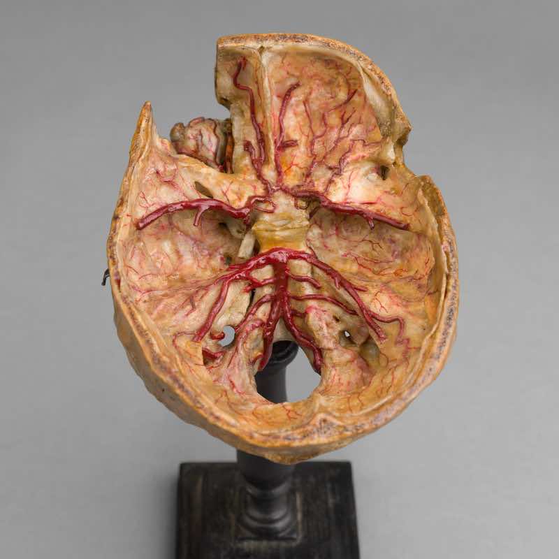 Anatomical Wax Model of Skull and Eye, between 1880 and 1900 - Image 5