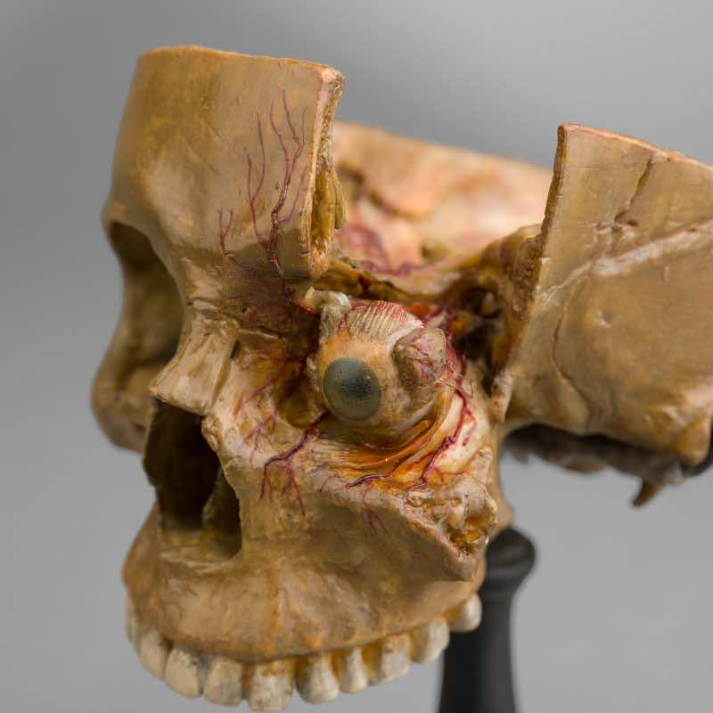 Anatomical Wax Model of Skull and Eye, between 1880 and 1900 - Image 2