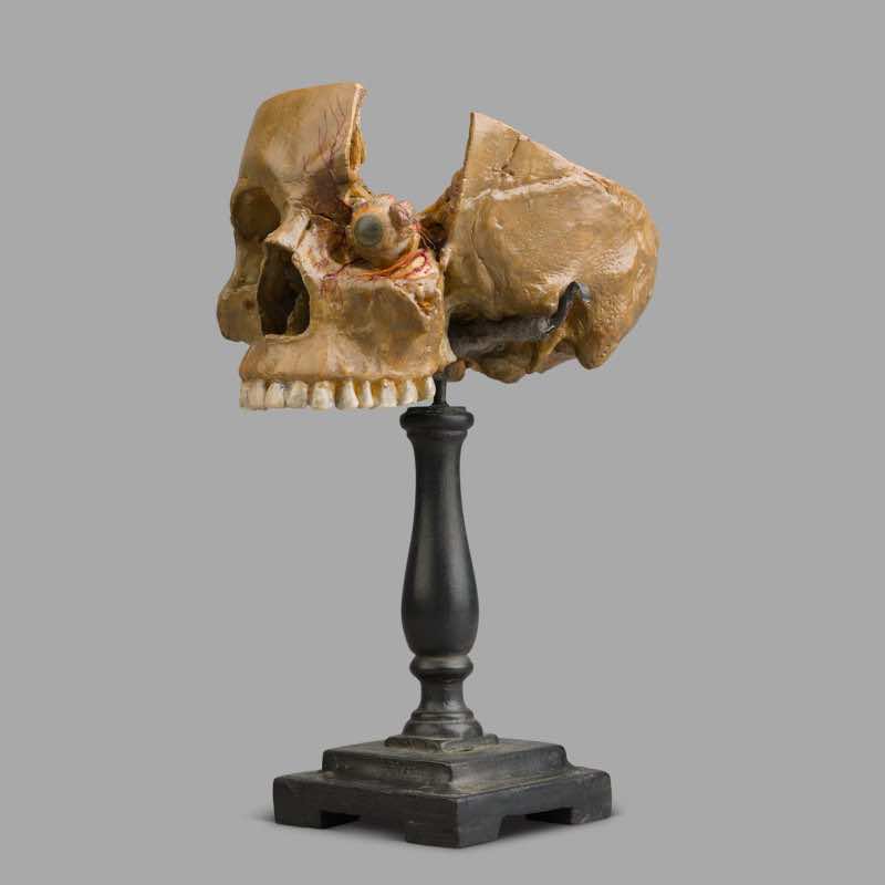 Anatomical Wax Model of Skull and Eye, between 1880 and 1900 - Image 3