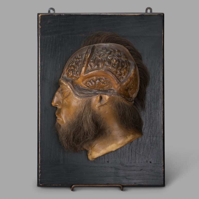 Modèle anatomique en cire, circa 1880