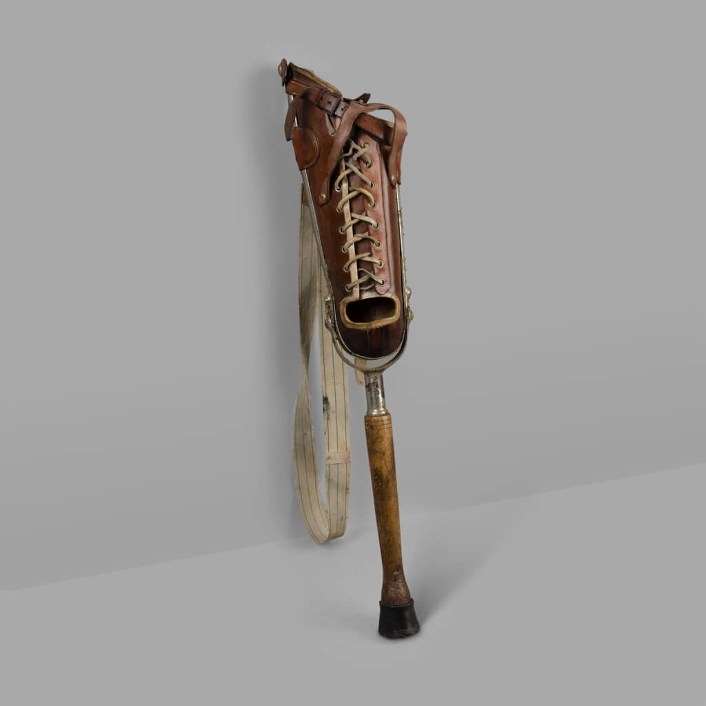 Leg prosthesis called “Pilon”