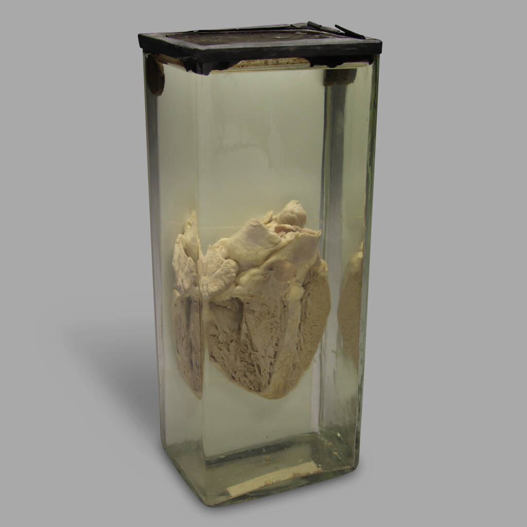 Formalin Preservation of a Human Heart Specimen