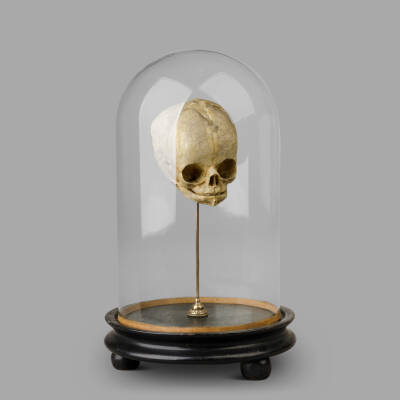 XIXth C. Anatomical Human Fetal Skull for Medical Study.