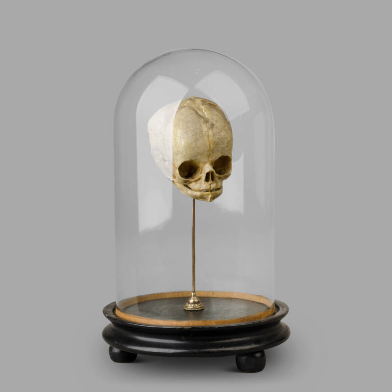 XIXth C. Anatomical Human Fetal Skull for Medical Study.