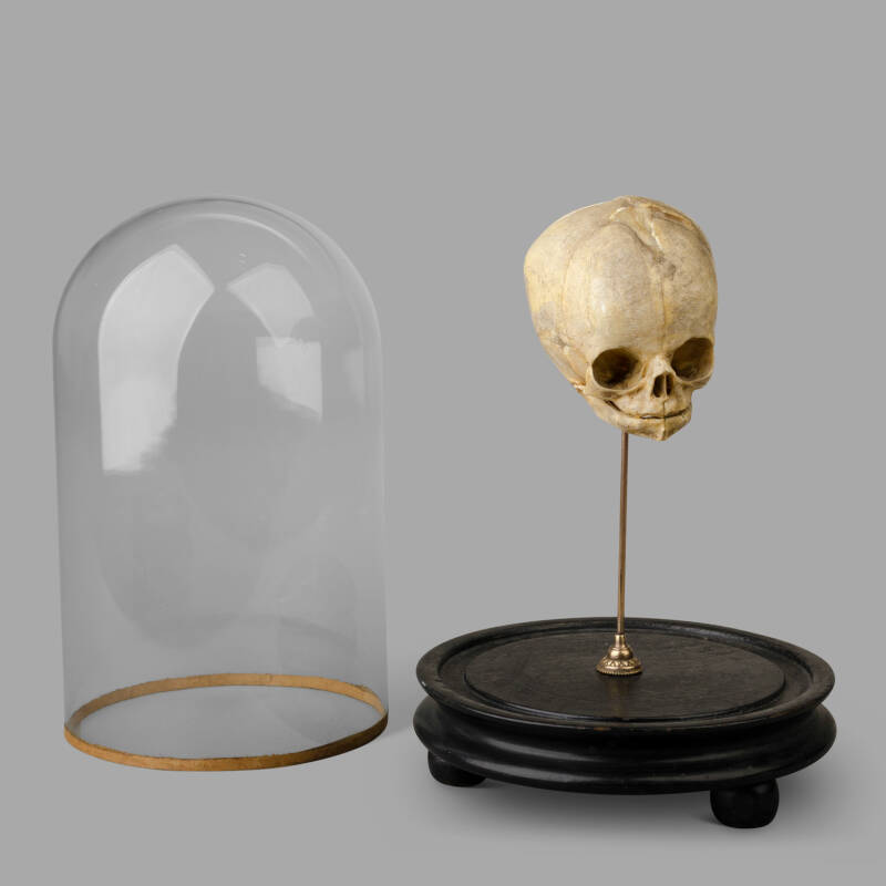 XIXth C. Anatomical Human Fetal Skull for Medical Study. - Image 2