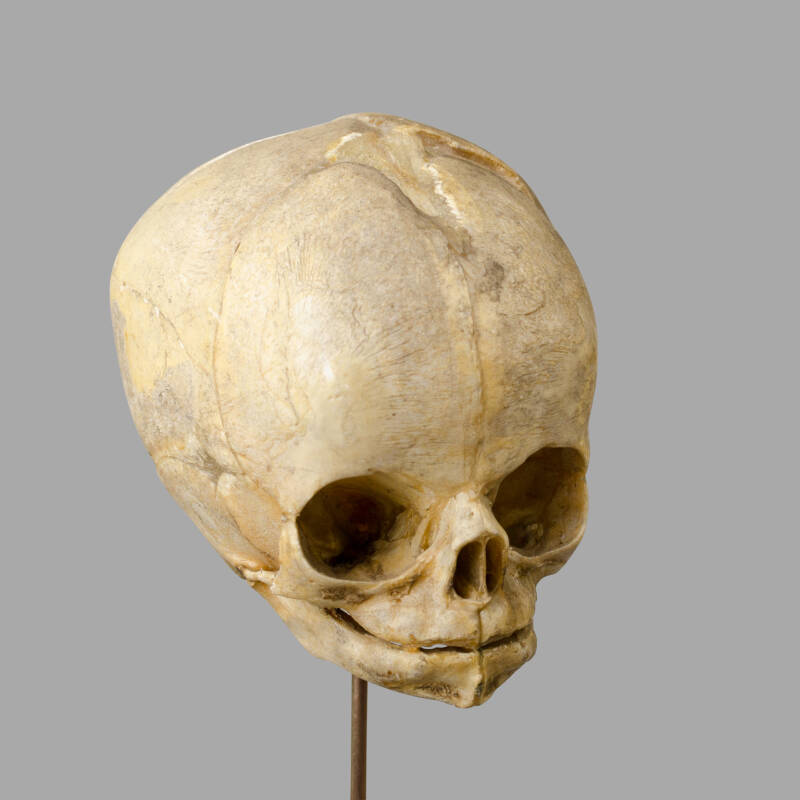 XIXth C. Anatomical Human Fetal Skull for Medical Study. - Image 7