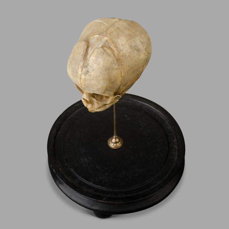 XIXth C. Anatomical Human Fetal Skull for Medical Study. - Image 6