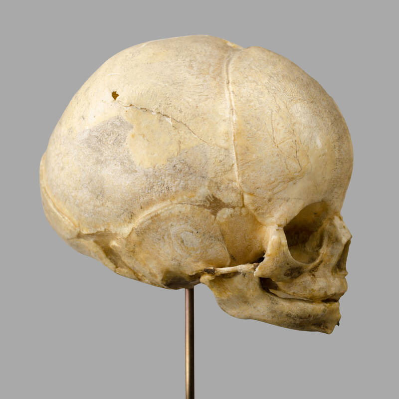 XIXth C. Anatomical Human Fetal Skull for Medical Study. - Image 5