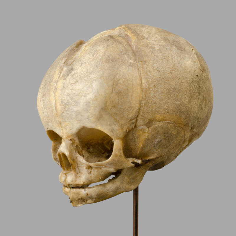 XIXth C. Anatomical Human Fetal Skull for Medical Study. - Image 4