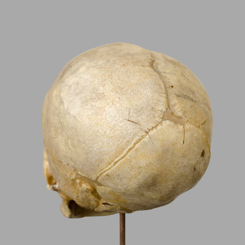 XIXth C. Anatomical Human Fetal Skull for Medical Study. - Image 3